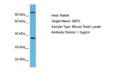 Western Blot: G6PC Antibody [NBP1-80533]