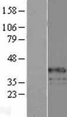 Western Blot: G6PC Overexpression Lysate [NBP2-09053]