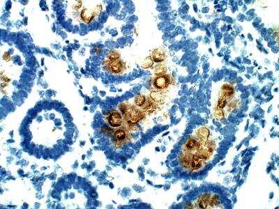 Immunohistochemistry-Paraffin: G6PC2 Antibody [NBP3-12306]