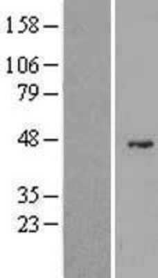 Western Blot: G6PC2 Overexpression Lysate [NBL1-10897]