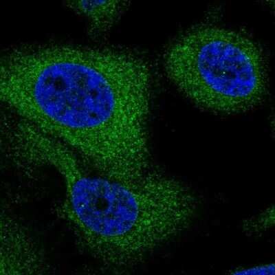 Immunocytochemistry/ Immunofluorescence: G6PC3 Antibody [NBP2-57778]