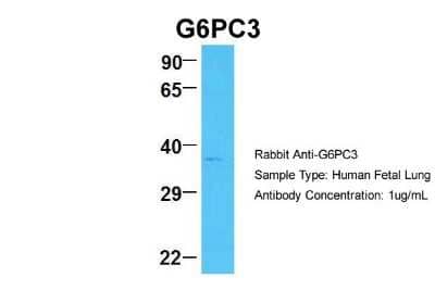 Western Blot: G6PC3 Antibody [NBP2-82857]