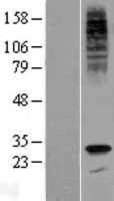 Western Blot: G6PC3 Overexpression Lysate [NBP2-05667]