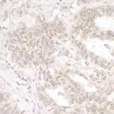 Immunohistochemistry-Paraffin: G9a/EHMT2 Antibody [NB100-40825]