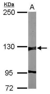 Western Blot: G9a/EHMT2 Antibody [NBP2-42846]