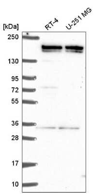 Western Blot: G9a/EHMT2 Antibody [NBP2-55881]