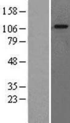 Western Blot: LYAG/GAA Overexpression Lysate [NBL1-10901]