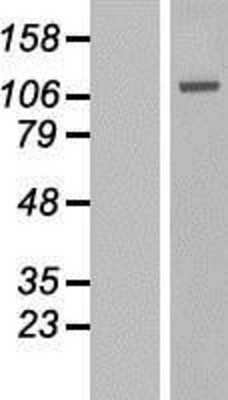 Western Blot: LYAG/GAA Overexpression Lysate [NBL1-10902]