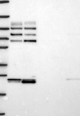 Western Blot: GAB1 Antibody [NBP3-17716]