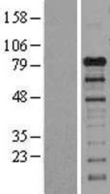 Western Blot: GAB1 Overexpression Lysate [NBL1-10903]