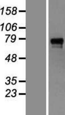 Western Blot: GAB1 Overexpression Lysate [NBL1-10904]