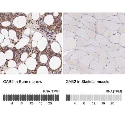 Immunohistochemistry-Paraffin: GAB2 Antibody [NBP1-81500]