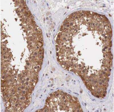 Immunohistochemistry-Paraffin: GAB2 Antibody [NBP1-81500]