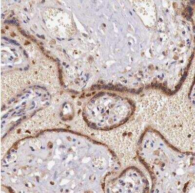 Immunohistochemistry-Paraffin: GAB2 Antibody [NBP1-81500]