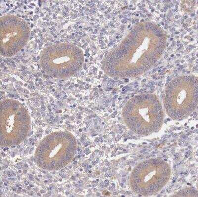 Immunohistochemistry-Paraffin: GAB2 Antibody [NBP1-81500]