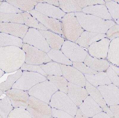 Immunohistochemistry-Paraffin: GAB2 Antibody [NBP1-81500]