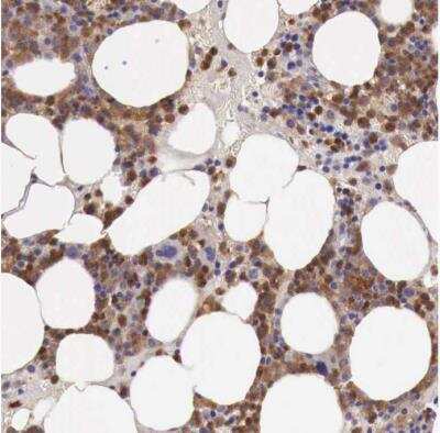 Immunohistochemistry-Paraffin: GAB2 Antibody [NBP1-81500]