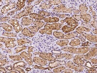 Immunohistochemistry-Paraffin: GAB2 Antibody [NBP2-97204]
