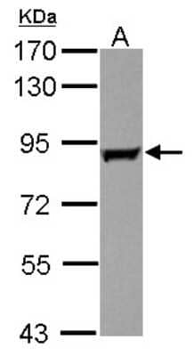 Western Blot: GAB2 Antibody [NBP2-16564]