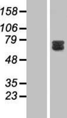 Western Blot: GAB2 Overexpression Lysate [NBP2-07465]