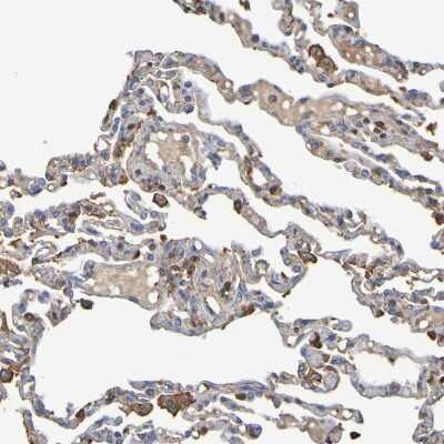 Immunohistochemistry-Paraffin: GAB3 Antibody [NBP1-86111]