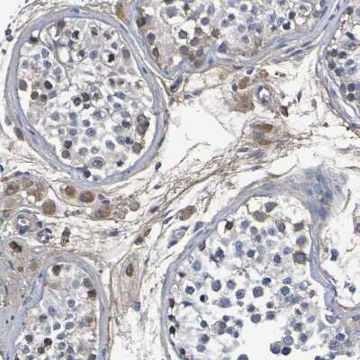 Immunohistochemistry-Paraffin: GAB3 Antibody [NBP1-86111]