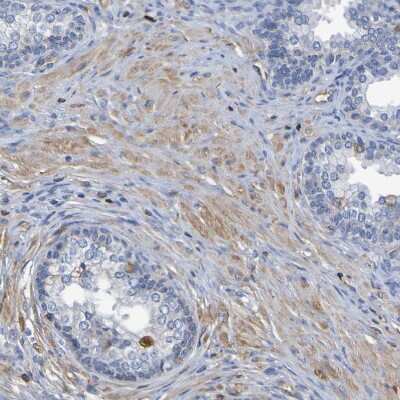 Immunohistochemistry-Paraffin: GAB3 Antibody [NBP1-86111]