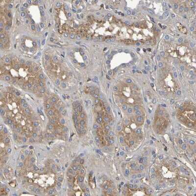 Immunohistochemistry-Paraffin: GAB3 Antibody [NBP1-86111]