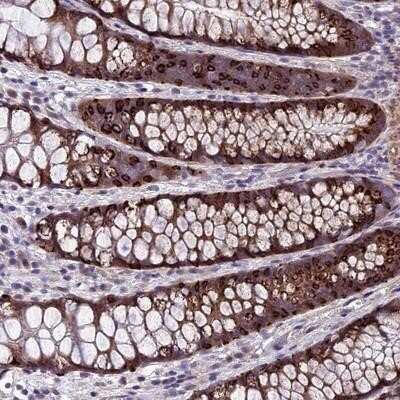 Immunohistochemistry-Paraffin: GAB4 Antibody [NBP1-91918]