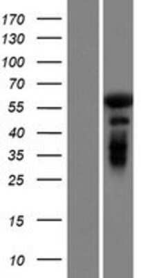 Western Blot: GAB4 Overexpression Lysate [NBP2-08558]