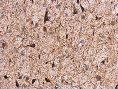Immunohistochemistry-Paraffin: GABA-AR alpha 1 Antibody [NBP2-16565]