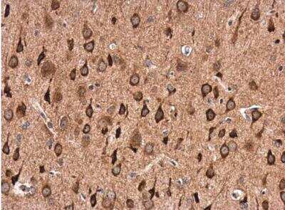 Immunohistochemistry-Paraffin: GABA-AR alpha 1 Antibody [NBP2-16565]