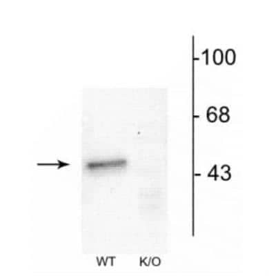 Western Blot: GABA-AR alpha 1 Antibody [NB300-191]