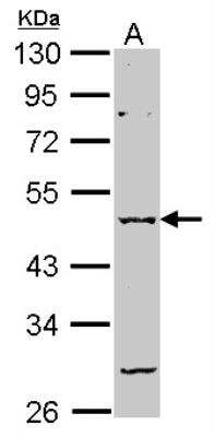 Western Blot: GABA-AR alpha 2 Antibody [NBP2-16566]