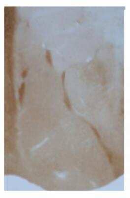 Immunohistochemistry: GABA-AR alpha 3 Antibody [NB100-61096]