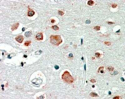 Immunohistochemistry-Paraffin: GABA-AR alpha 4 Antibody [NBP1-18844]