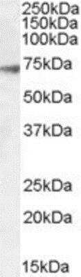 Western Blot: GABA-AR alpha 4 Antibody [NBP1-18844]