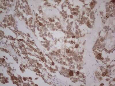 Immunohistochemistry: GABA-AR alpha 5 Antibody (OTI1G9) [NBP2-45752]