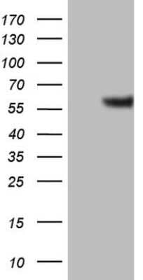 Western Blot: GABA-AR alpha 5 Antibody (OTI1G9) [NBP2-45752]