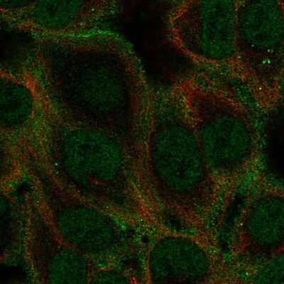 Immunocytochemistry/ Immunofluorescence: GABA-AR alpha 5 Antibody [NBP2-57683]