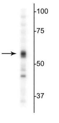 Western Blot: GABA-AR alpha 5 Antibody [NB300-195]