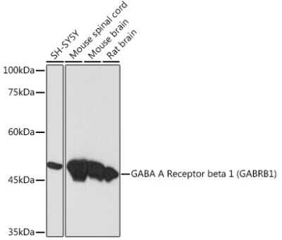 Western Blot: GABA-A R beta 1 Antibody (1Q3A9) [NBP3-15857]