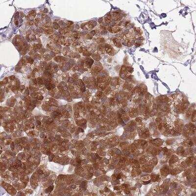 Immunohistochemistry-Paraffin: GABA-A R beta 1 Antibody [NBP2-14034]