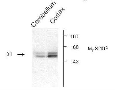 Western Blot: GABA-A R beta 1 Antibody [NB300-197]