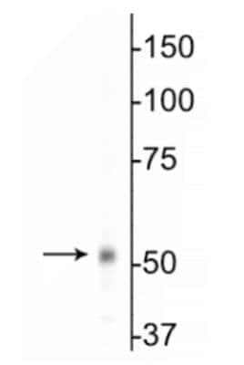 Western Blot: GABA-A R beta 1 Antibody [NB300-197]