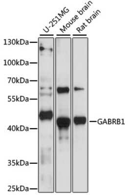 Western Blot: GABA-A R beta 1 AntibodyAzide and BSA Free [NBP3-03078]