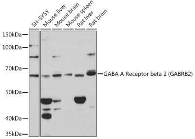 Western Blot: GABA-A R beta 2 Antibody (6G9O8) [NBP3-15403]