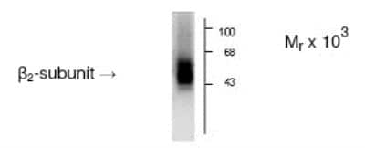 Western Blot: GABA-A R beta 2 Antibody [NB300-198]