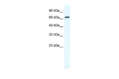 Western Blot: GABA-A R beta 2 Antibody [NBP2-82224]