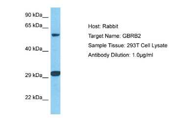 Western Blot: GABA-A R beta 2 Antibody [NBP2-82225]